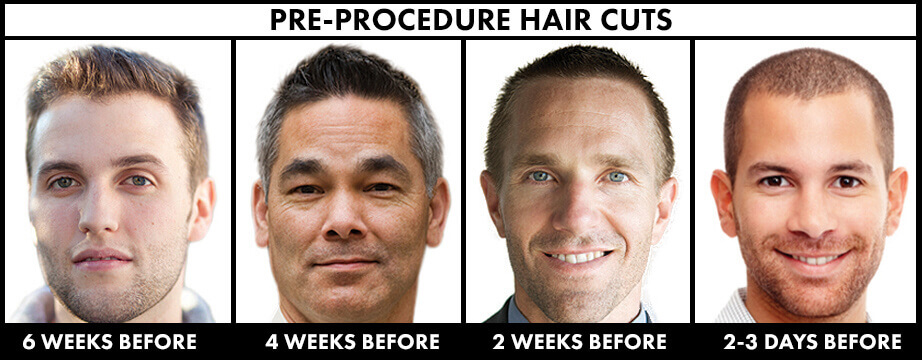 Pre-Procedure Hair Cuts